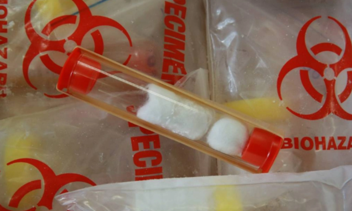 Cancer Samples